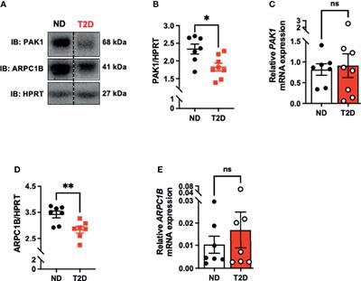 Changes in Skeletal Muscle PAK1 Levels Regulate Tissue Crosstalk to Impact Whole Body Glucose Homeostasis